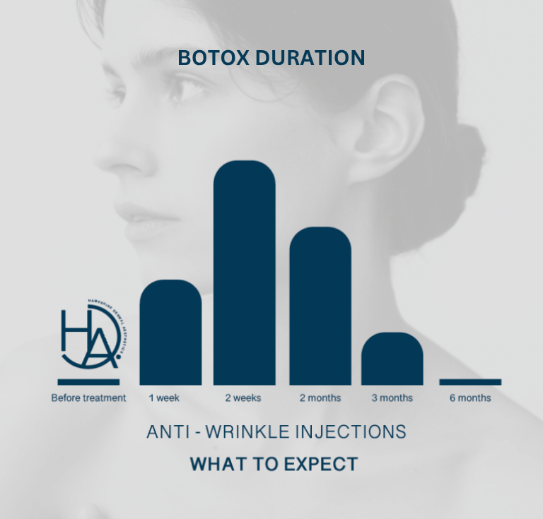 Anti Wrinkle Injections