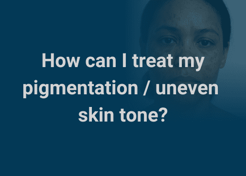 How can I treat my pigmentation