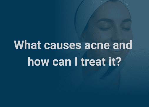 What causes acne and how can I treat it