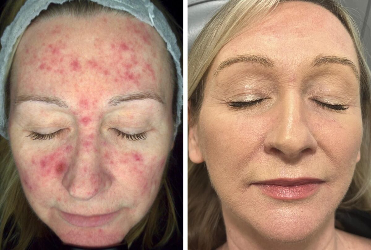 Before-and-After-Skin